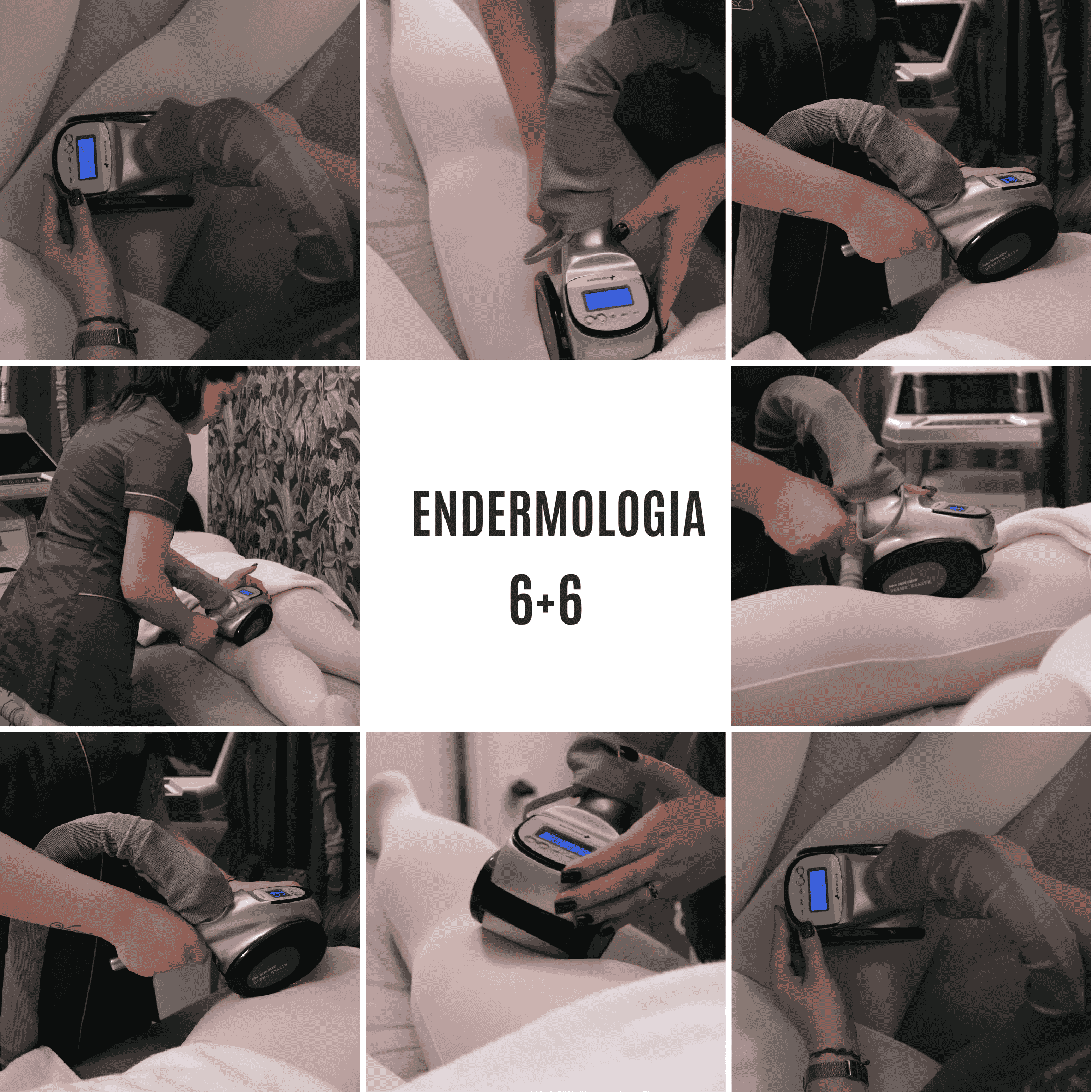 ENDERMOLOGIA 6+6